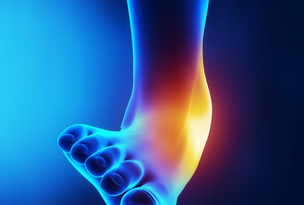 Why You Shouldn’t Ignore a Sprained Ankle