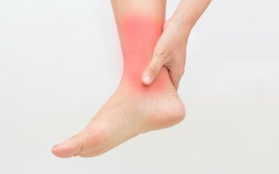 Will a Sprained Ankle Heal on Its Own?