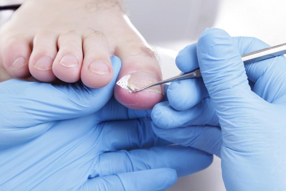 Here’s How to Cut Your Toenails So You Don’t Get an Ingrown Toenail