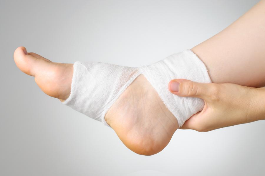 5 Important Ways to Care for Your Sprained Ankle
